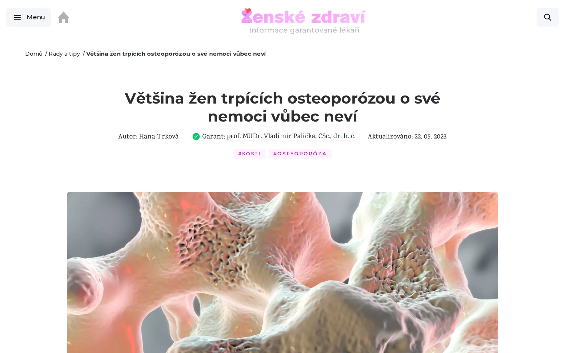 Detail článku o osteoporóze s autorem, lékařským garantem, datem aktualizace a štítky